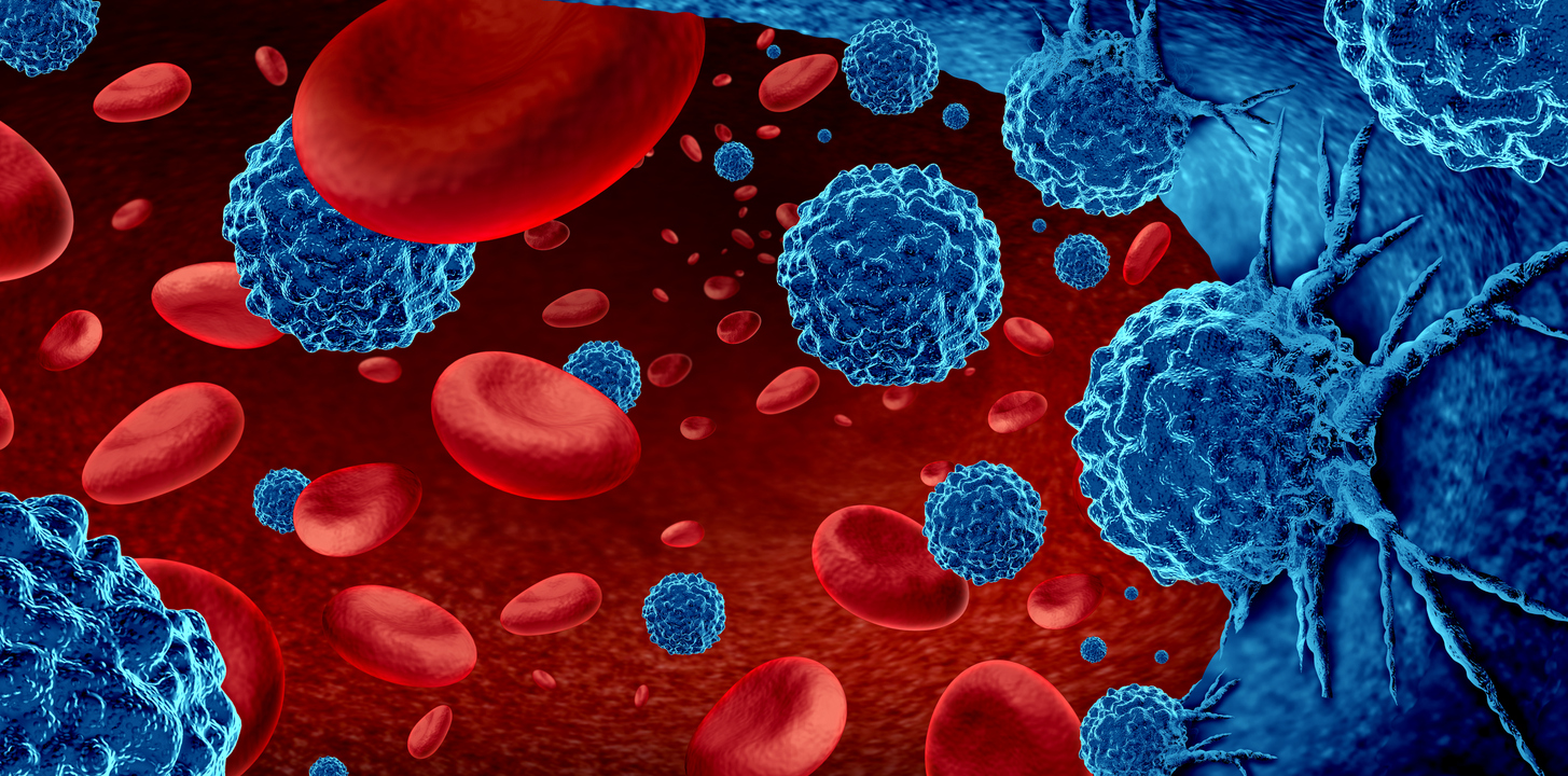 3D rendering of cancer cells in the blood